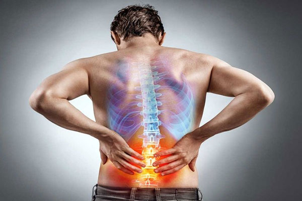 درمان-دیسک-کمر
