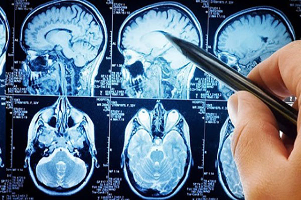 متخصص-مغز-و-اعصاب-در-تهران