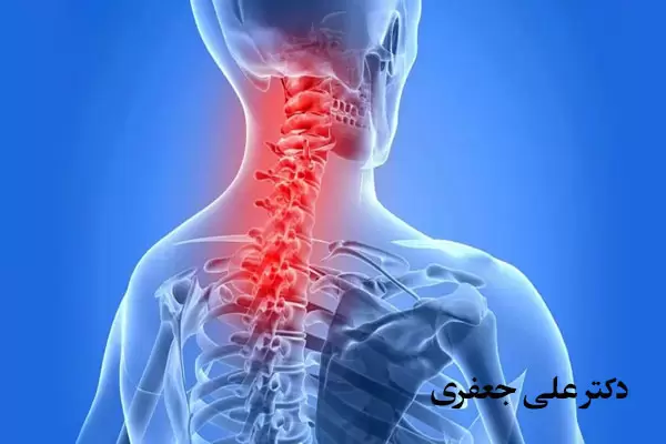 جراحی-آرتروز-گردن