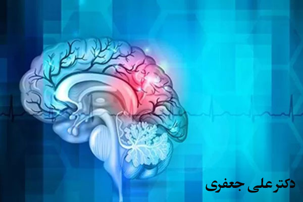  بهترین دکتر عروق مغزی در تهران 
