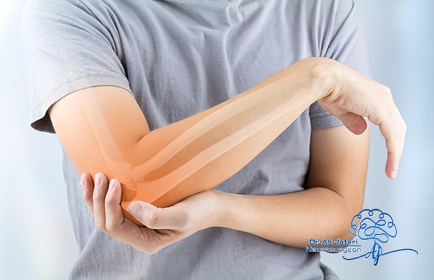درد-آرنج-چیست؟