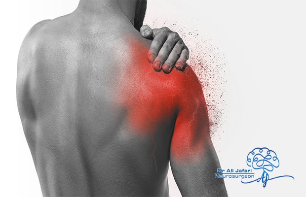 علل شایع درد شانه